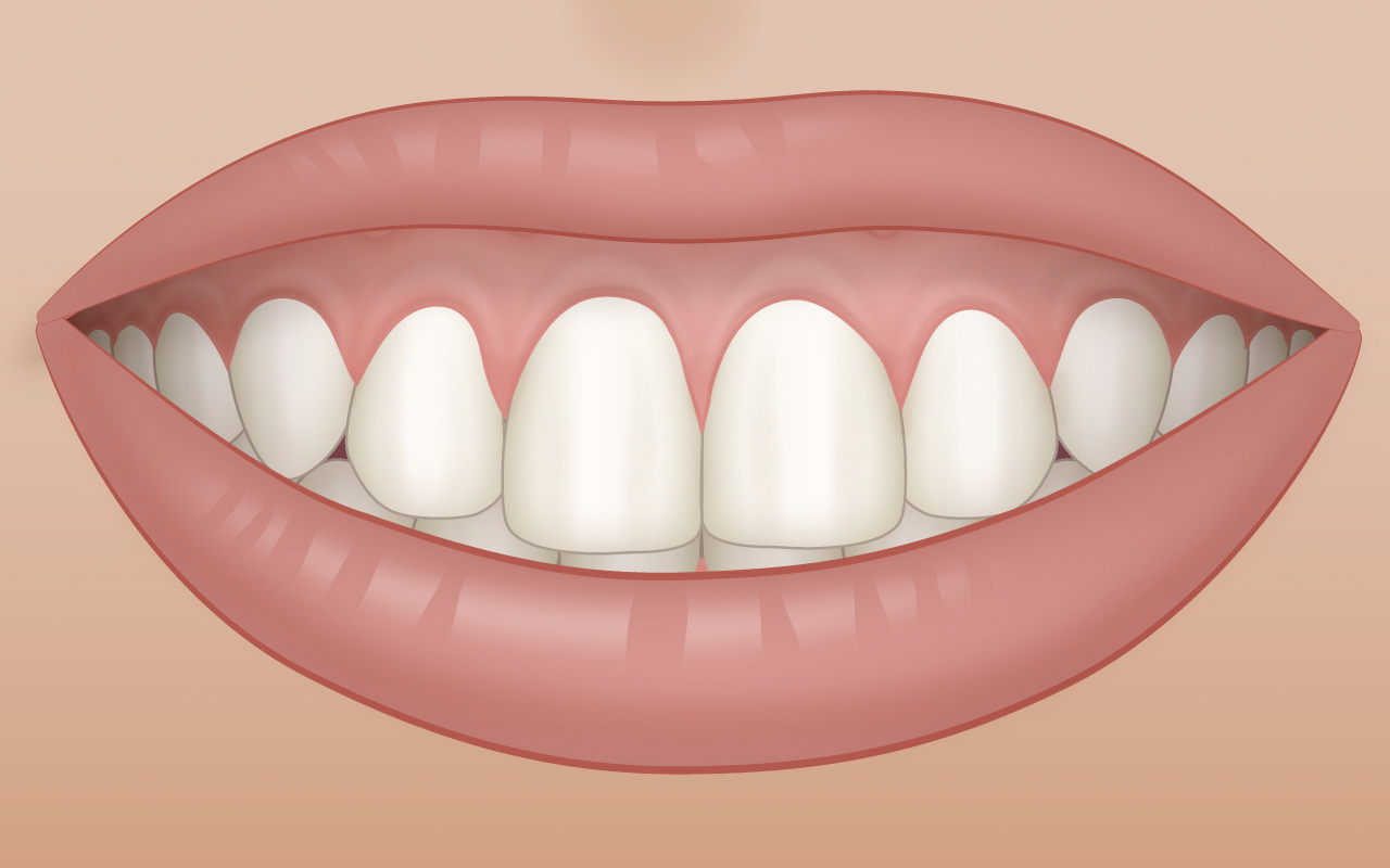 Healthy Gums